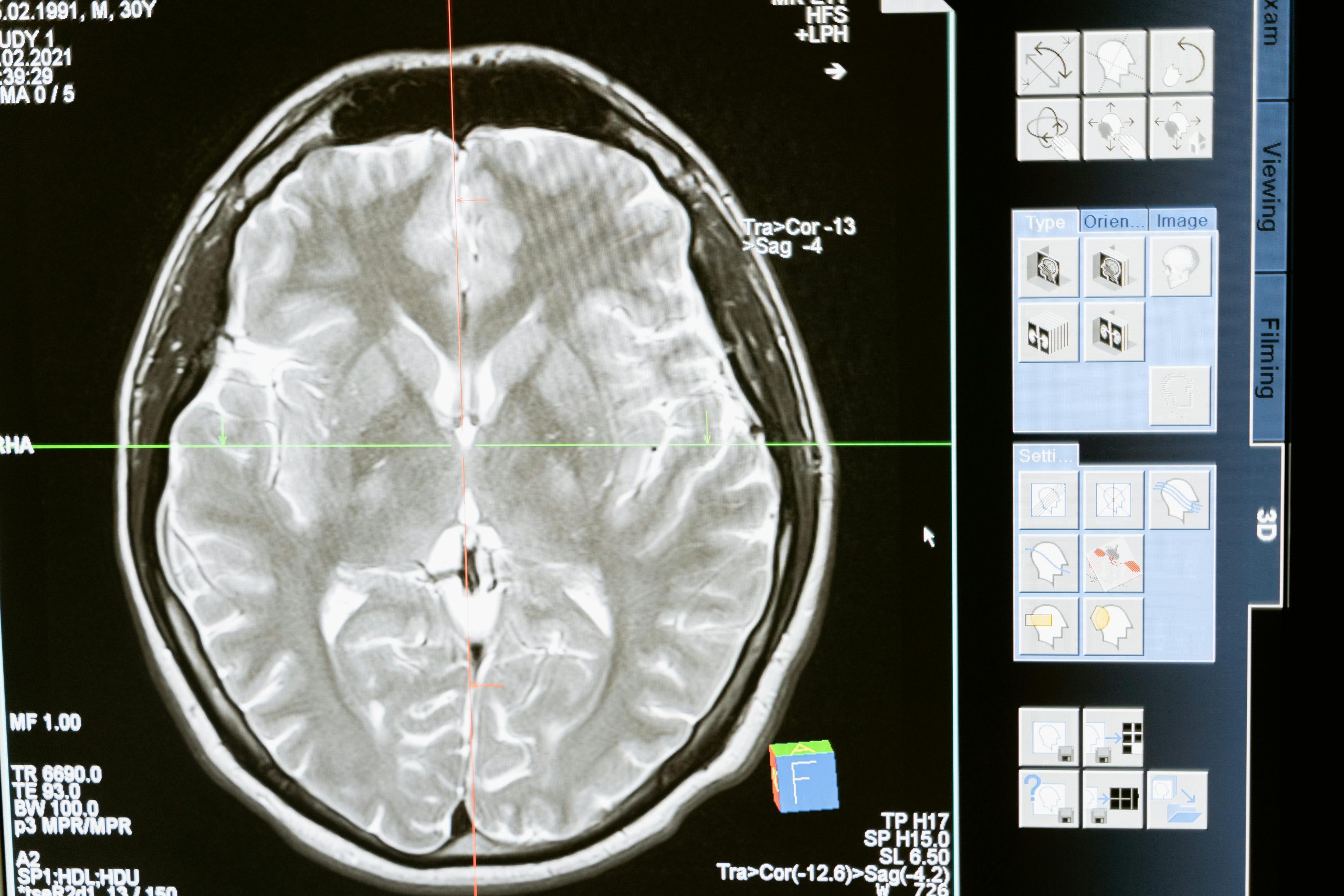 The Scientific Basis of Diet and Brain Development